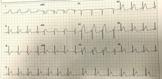 Quand aller aux urgences ? Trop tôt, à temps ou trop tard